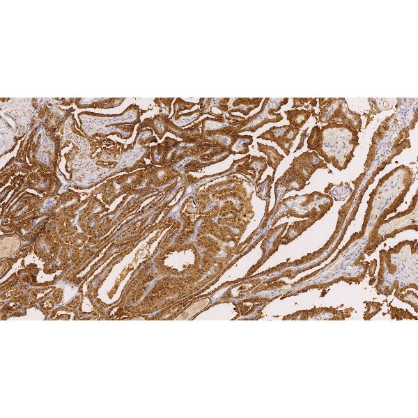 Galectin-3